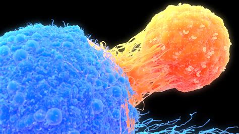 Genetically Engineered Immune Cells Have Kept Two People Cancer Free