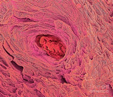 Blocked Sweat Gland Photograph By Steve Gschmeissnerscience Photo