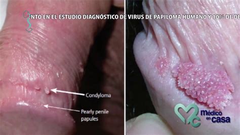 Simple Science: How to Make a Volcano with Kids