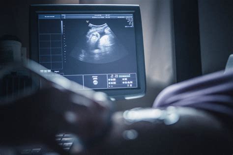 When And Why To Get Ultrasounds During Pregnancy The New York Times