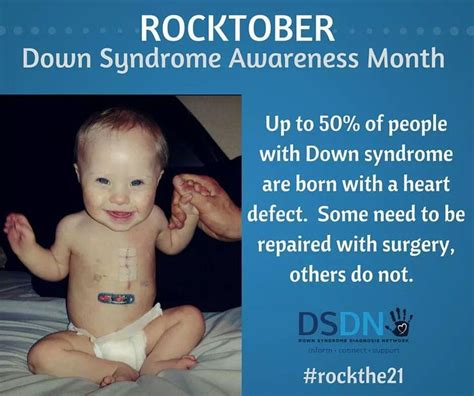 What Are The 3 Types Of Down Syndrome This Will Help Website Stills