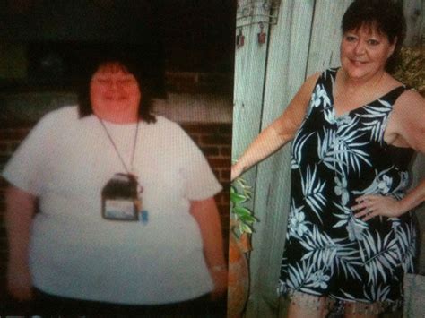 Retired Teacher Loses 200 Pounds Shares Success Story And Advice