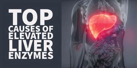 Top Causes Of Elevated Liver Enzymes Lower Your Ast And Alt