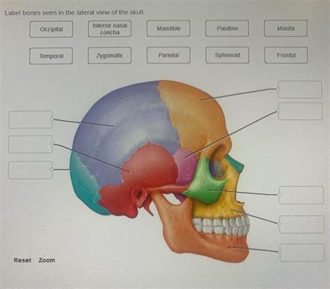 Solved Label Bones Seen In The Lateral View Of The Skull