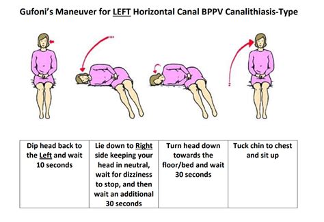 Printable Epley Maneuver Pdf