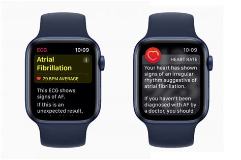 Apple Watch Ecg App Now Officially Available For Malaysia Alongside