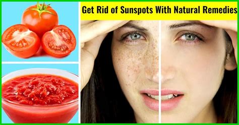 When melanoma occurs in people with dark skin tones, it's more likely to occur in areas not normally exposed to the s. Are sunspots stopping you from stepping out into the sun ...