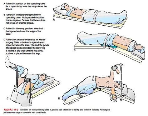 Perioperative Nursing Preventing Intraoperative Positioning Injury