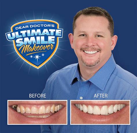 Smile Makeover Contest Winner Brian Cosmetic Dental Makeover