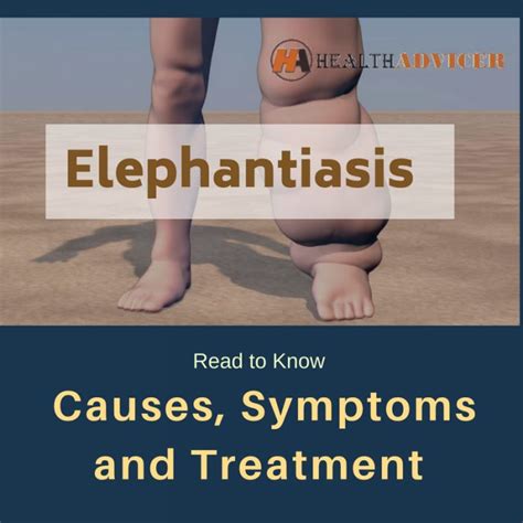 Elephantiasis Causes Symptoms Treatment And Prevention