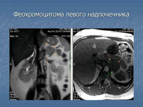Норма и патология органов забрюшинного пространства - online presentation Картинка - Норма и патология органов забрюшинного пространства - online presentation
