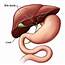 Bile Duct Cancer Overview  Health Encyclopedia University Of