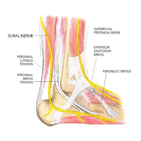 Occasional Injuries Sural Nerve Neuropathy 2023