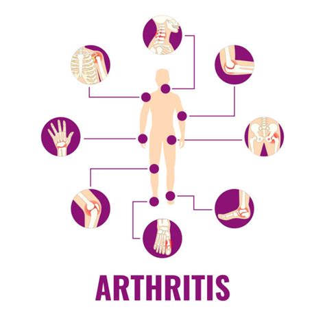 Hands With Rheumatoid Arthritis Backgrounds Illustrations Royalty Free