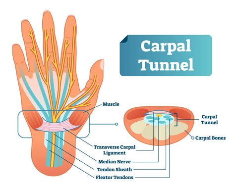 What Is The Carpal Tunnel Wrist Tendons Median Nerve