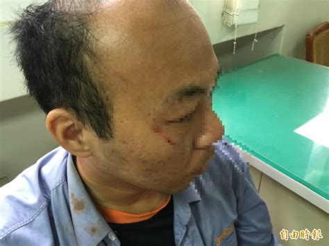 大都會 55178 計程車 車資估算器，台灣各地計程車費用如何計算？ 全台各地計程車費率、計程車收費金額一次為您計算好。 如須預估車資，請輸入您的所在地（上車地）及目的地（下車地）查詢，即可為您快速計算出計程車跳. 不滿停電太久 民眾怒砸台電人車 - 社會 - 自由時報電子報