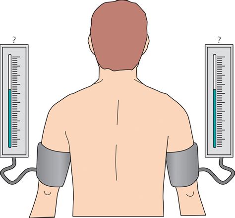 Albums 90 Images Picture Of Arm Position When Taking Blood Pressure Superb