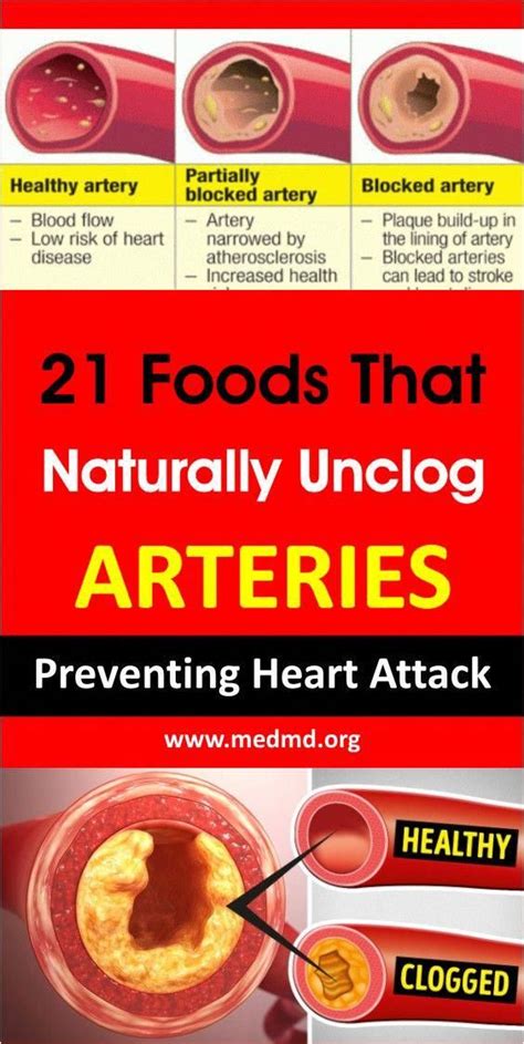 21 Foods That Naturally Unclog Arteries In 2020 Foods For Heart