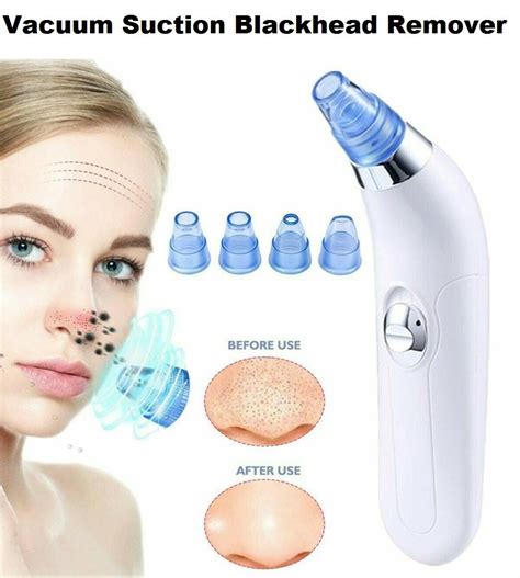 Kamaly Vacuum Suction Blackhead Remover Nose Facial Pore Cleaner