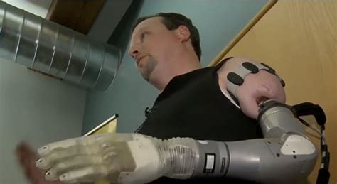 Prosthetic Arm Controlled By Thoughts Developed In New Hampshire