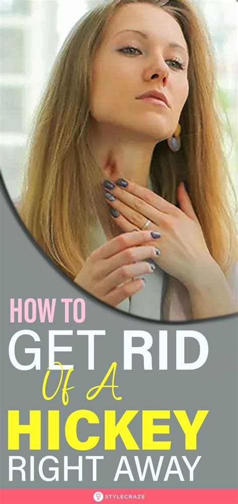 how to get rid of a hickey 13 simple ways how to get rid rid hickeys