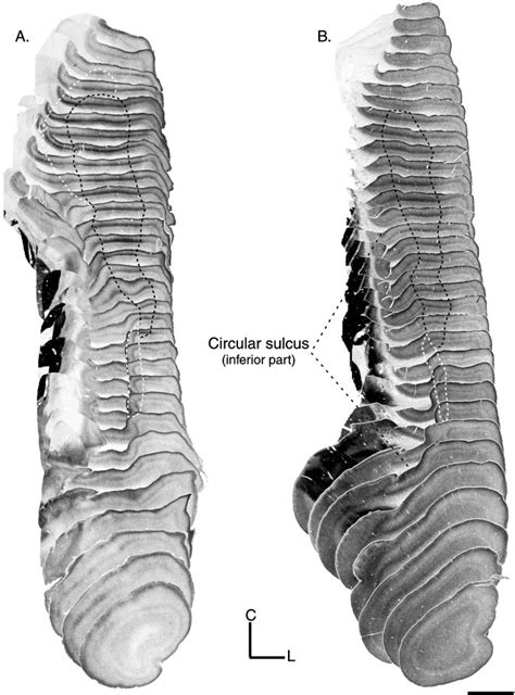 Reconstructions Of Ache Sections Showing Location Of The Core Region