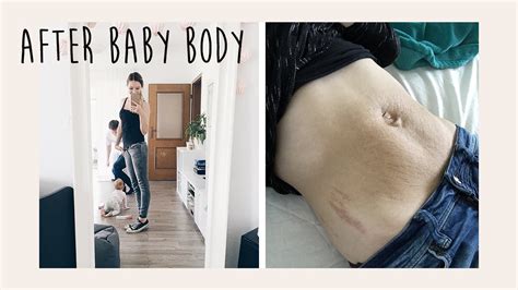 After Baby Body Bauch 8 Monate Nach Der Schwangerschaft Update