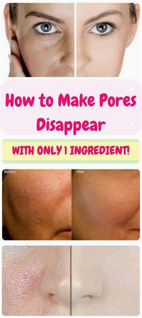 How To Make Pores Disappear With Only 1 Ingredient Healthy Tips