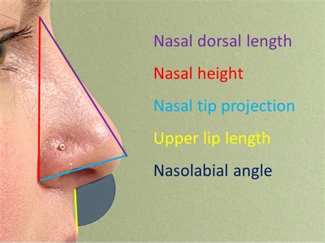 Figure Definitions Of Nasal Measurements In Statpearls Ncbi