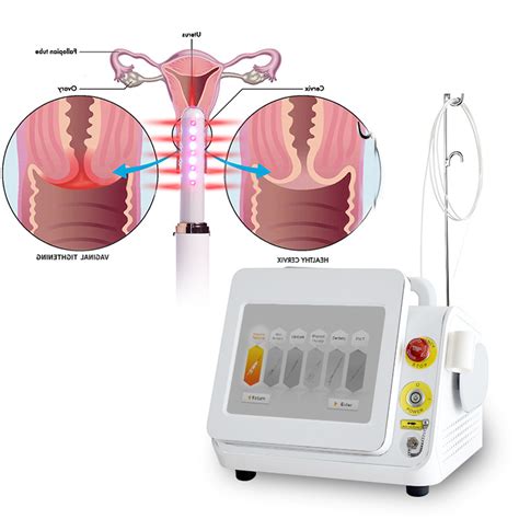 Diode Laser Vaginal Tightening 980 1470nm Gynecological Laser Women