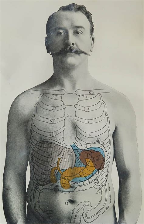 Original Vintage Medical Print Liver Spleen And Pancreas Circa 1900