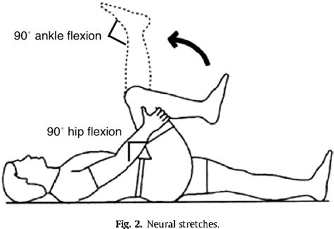 Where Is The Nerve Root Impingement For Disc Rehab