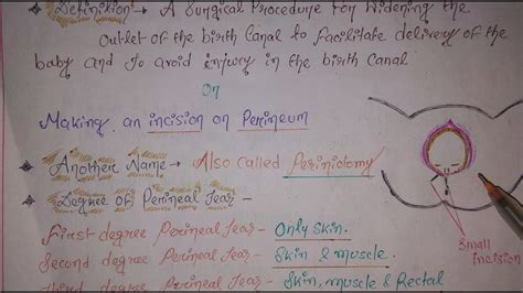 Episiotomy Youtube