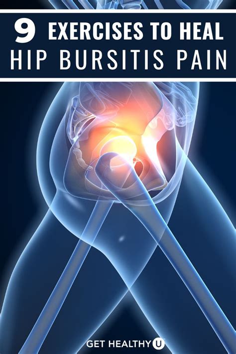 9 Best Exercises For Hip Bursitis Video Included Bursitis Hip