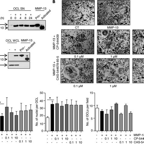 Mmp 13dependent Osteoclastogenesis Proceeds Independently Of
