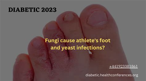 Fungi Cause Athletes Foot And Yeast Infections
