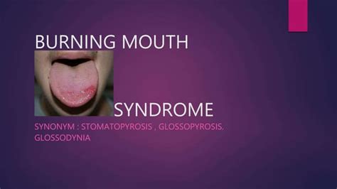 Burning Mouth Syndrome Causes Symptoms And Treatment Ppt