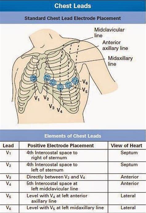 Standard Chest Lead Electrode Placement Nurse Nursing Notes Nursing