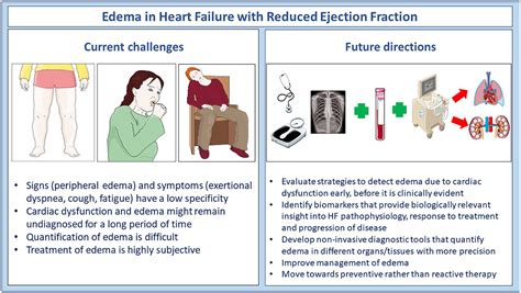 Frontiers Editorial Edema In Heart Failure With Reduced Ejection