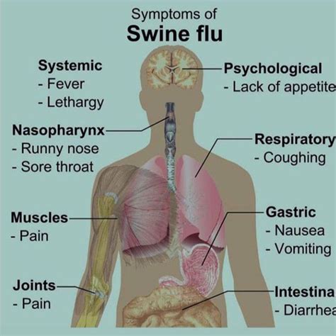 Swine Flu Medizzy