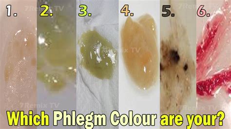 What Does The Color Of Phlegm Mean What Does The Color Of Phlegm Mean