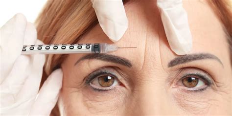 9 Common Myths And Misconceptions About Botox Explained