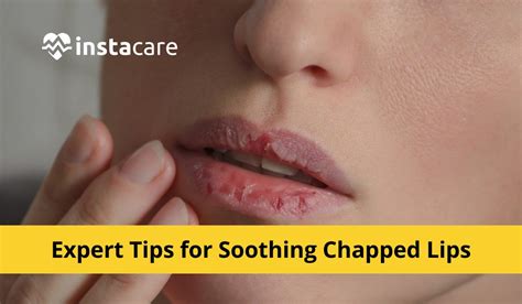 7 Expert Tips For Healing Dry Chapped Lips