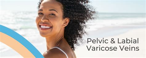 Pelvic And Labial Varicose Veins Treatment Options