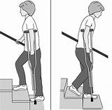 Images of How To Use One Crutch After Foot Surgery