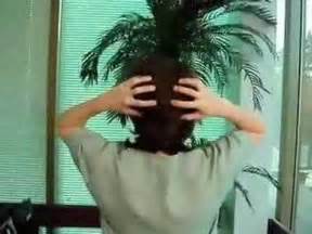 Hair Transplant Surgery-Scalp Stretch Exercise - YouTube