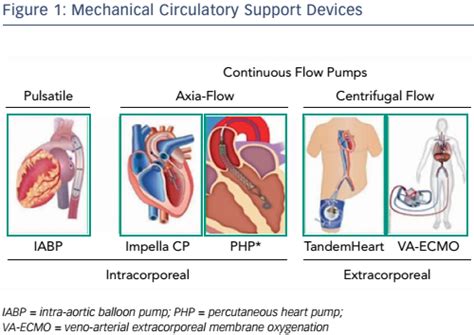 Mechanical Circulatory Support Devices Radcliffe Cardiology