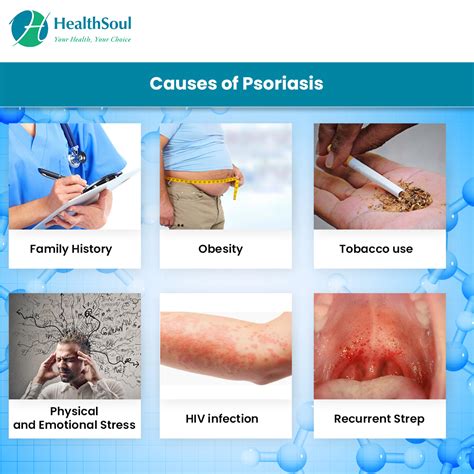 How Does Stress Cause Psoriasis