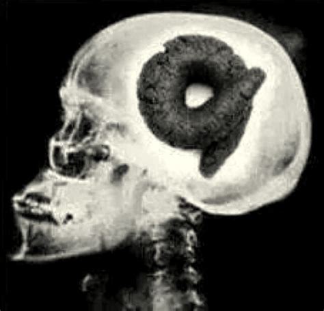 X Rays Poop Brains 4 Blank Template Imgflip