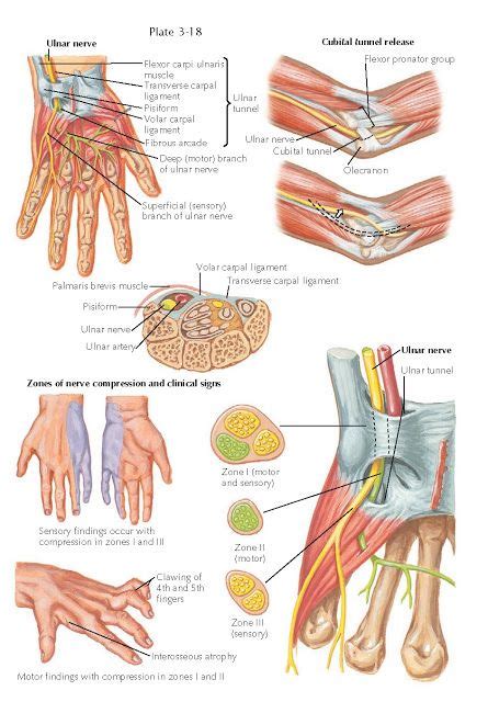 Cubital Tunnel Syndrome In 2020 Cubital Tunnel Syndrome Syndrome